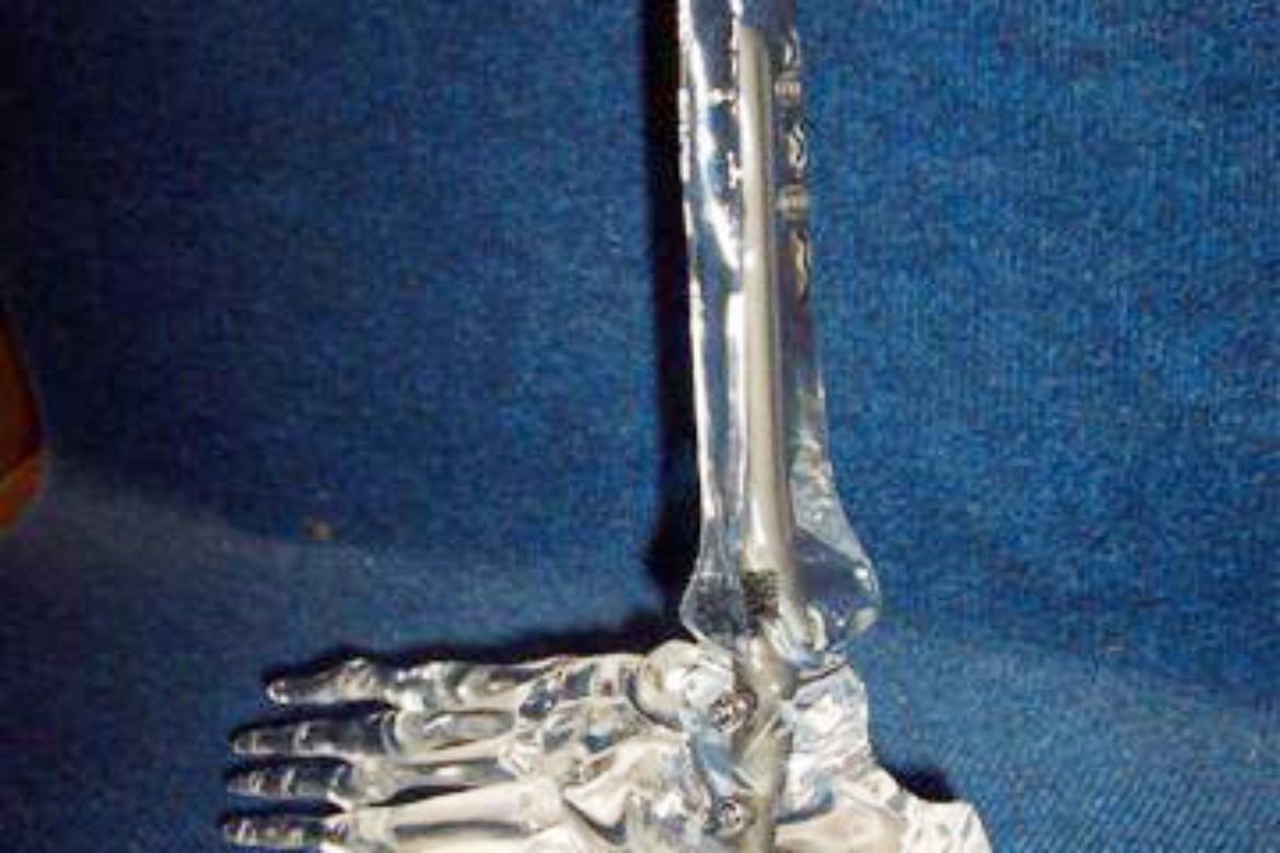 Stryker_Ankle