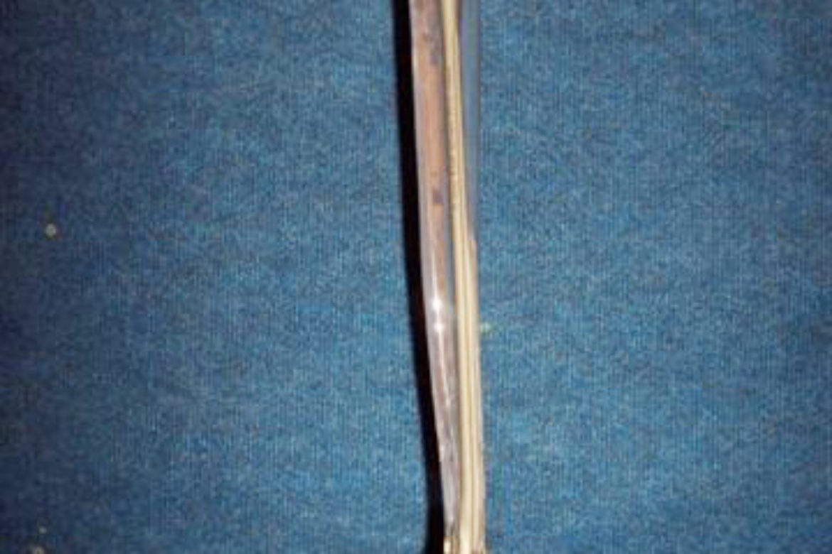 Stryker_Tibia_Nail