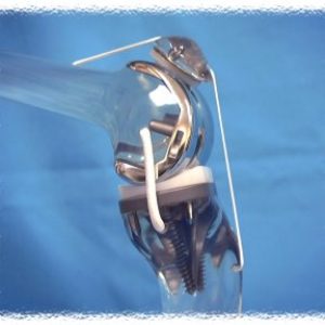 https://www.cdcdesigninc.com/wp-content/uploads/2016/06/boneknee2-300x300.jpg