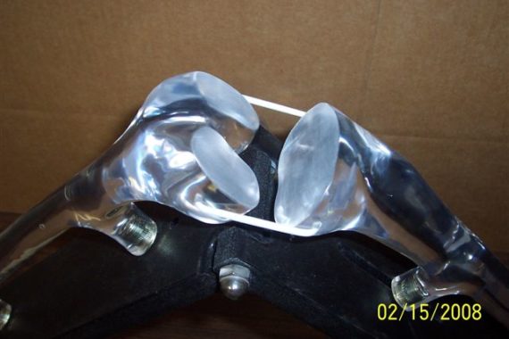 depuy chorous line step 2