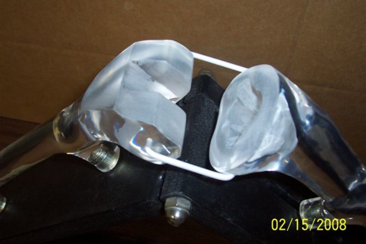 depuy chorous line step 5