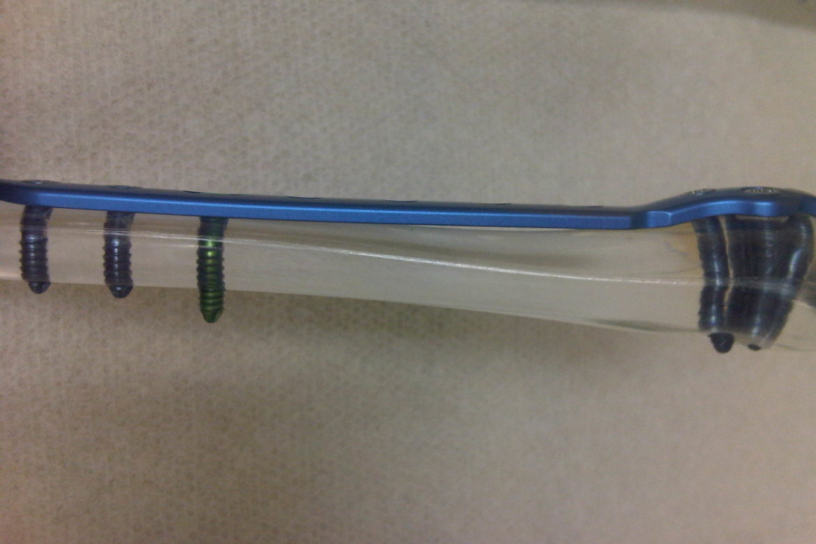 img00622-20120502-1138
